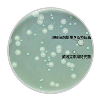 单核�l�胞增生李斯�Ҏ��菌培�ȝ���? /><span style=